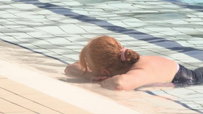 Nemcsak a napégés okozhat bőrproblémákat, de a strandokon terjedő baktériumok is