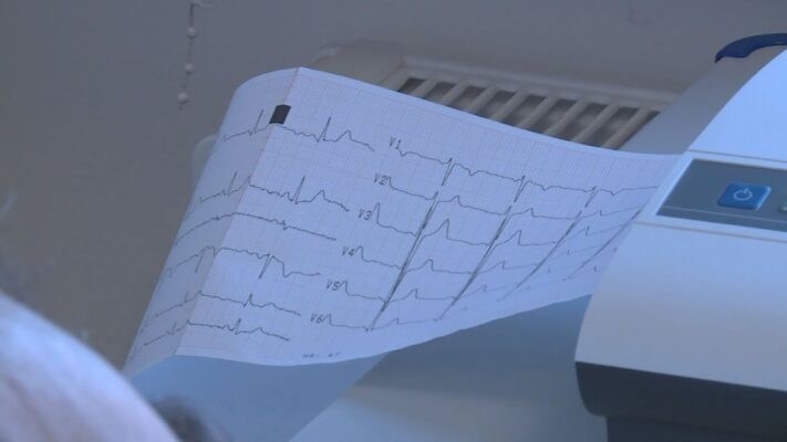Folytatónak a keringési betegségek megelőzését segítő szűrések a Városmajori Szívklinikán